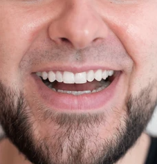 Resultado Después 1